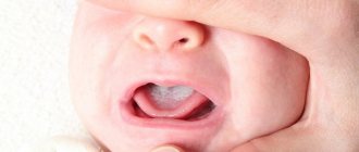 how to treat thrush in newborns